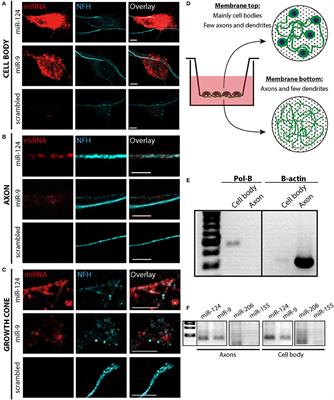 Localization of RNAi Machinery to Axonal Branch Points and Growth Cones Is Facilitated by Mitochondria and Is Disrupted in ALS